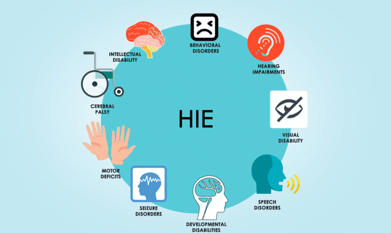 HIE Birth Injuries